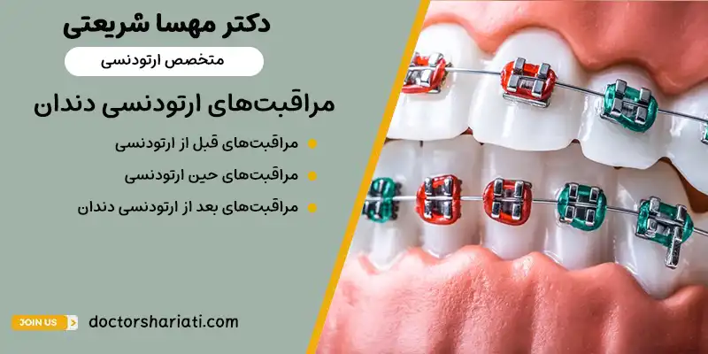 مراقبت های ارتودنسی دندان