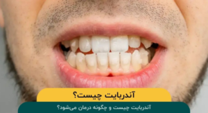 آندربایت چیست و چگونه درمان میشود؟