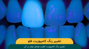 مراقبتهای بعد از استفاده از کامپوزیت فلو: راهنمای جامع برای سلامت دندانها