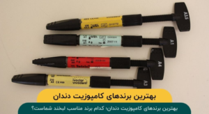بهترین برندهای کامپوزیت دندان