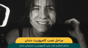 مراحل نصب کامپوزیت دندان