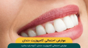 عوارض احتمالی کامپوزیت دندان: آنچه باید بدانید