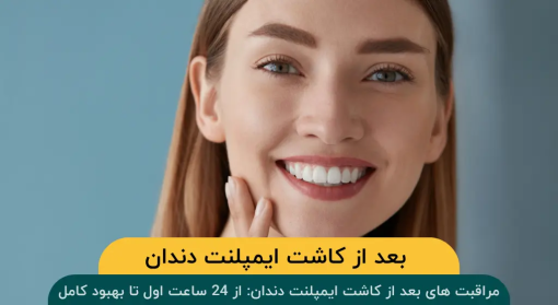 مراقبت های بعد از کاشت ایمپلنت دندان: از 24 ساعت اول تا بهبود کامل