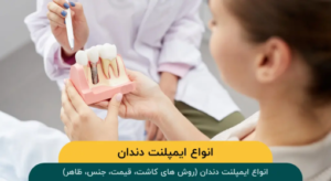 انواع ایمپلنت دندان (روش های کاشت، قیمت، جنس، ظاهر)