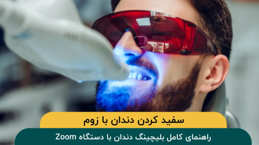سفید کردن دندان با زوم: راهنمای کامل بلیچینگ دندان با دستگاه Zoom