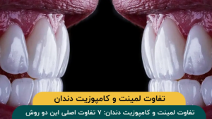تفاوت لمینت و کامپوزیت دندان: ۷ تفاوت اصلی این دو روش زیبایی دندان