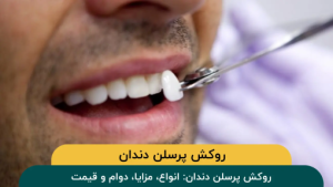 روکش پرسلن دندان: انواع، مزایا، دوام و قیمت