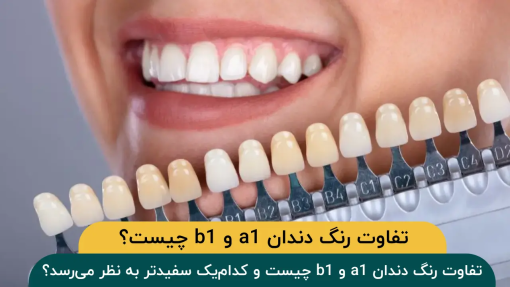 تفاوت رنگ دندان A1 و B1؛ کدام سفیدتر است؟