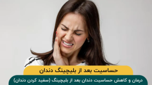 درمان و کاهش حساسیت دندان بعد از بلیچینگ (سفید کردن دندان)