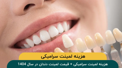 هزینه لمینت سرامیکی + قیمت لمینت دندان در سال 1404
